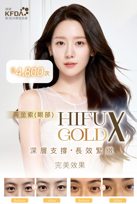 HIFU GOLD黃金索(眼部)