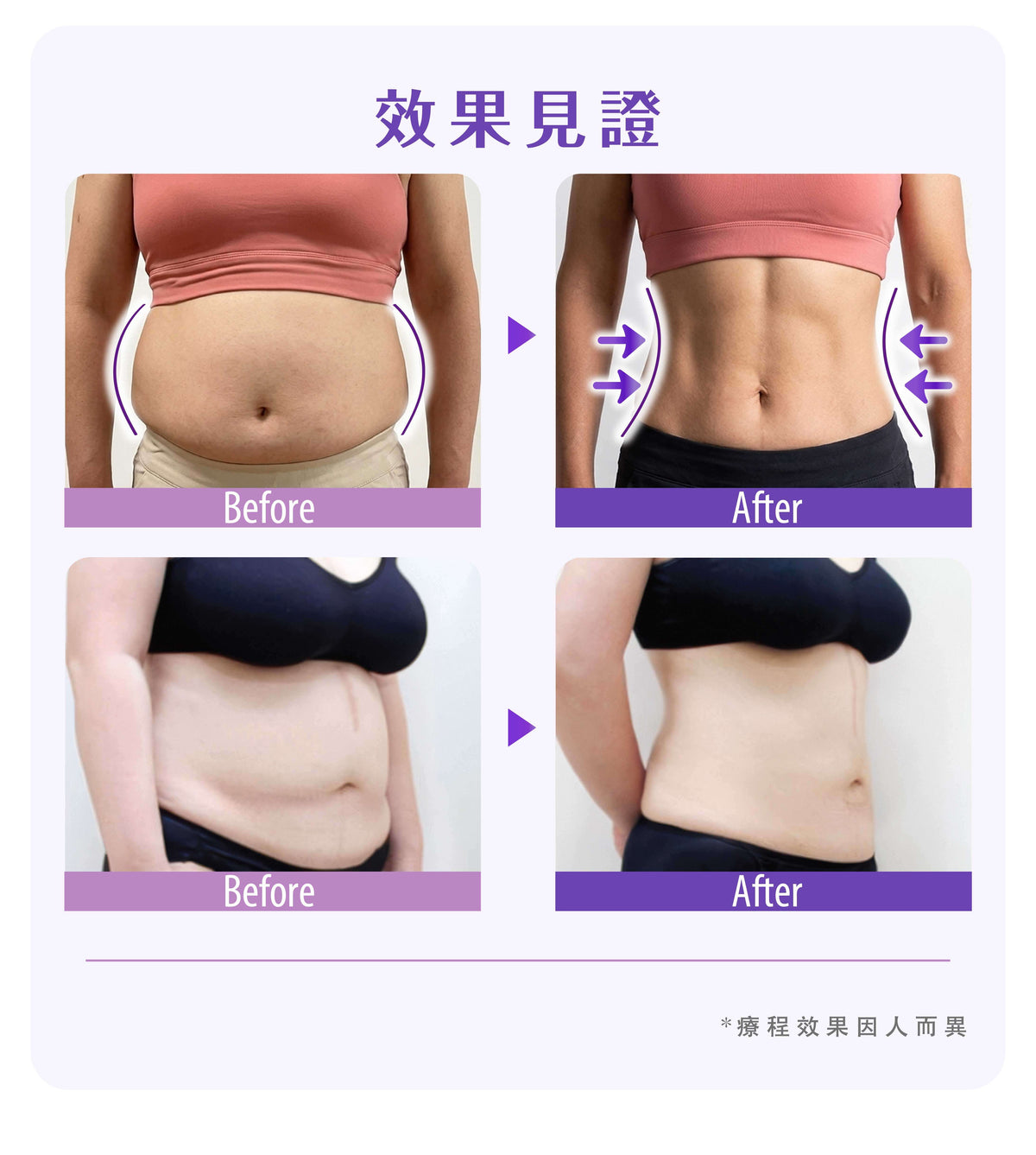 【新客網店優惠】S6溶脂修形療程✨$988/5次 | 送full body 脂肪檢測