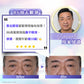 【新客網店限定】眼袋救星🔥R6包去眼袋療程 $988/5次