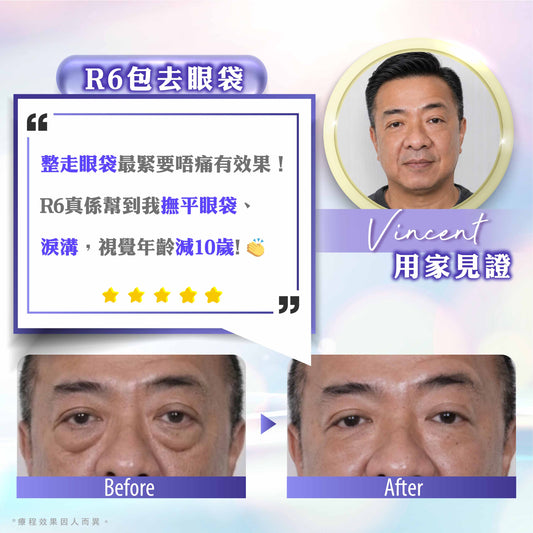 【新客網店限定】眼袋救星🔥R6包去眼袋療程 $988/5次
