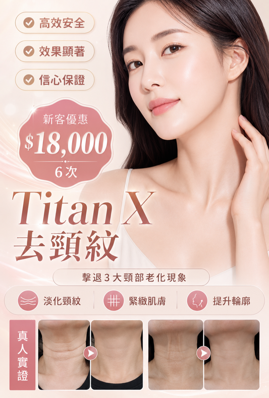 Titan X 去頸紋