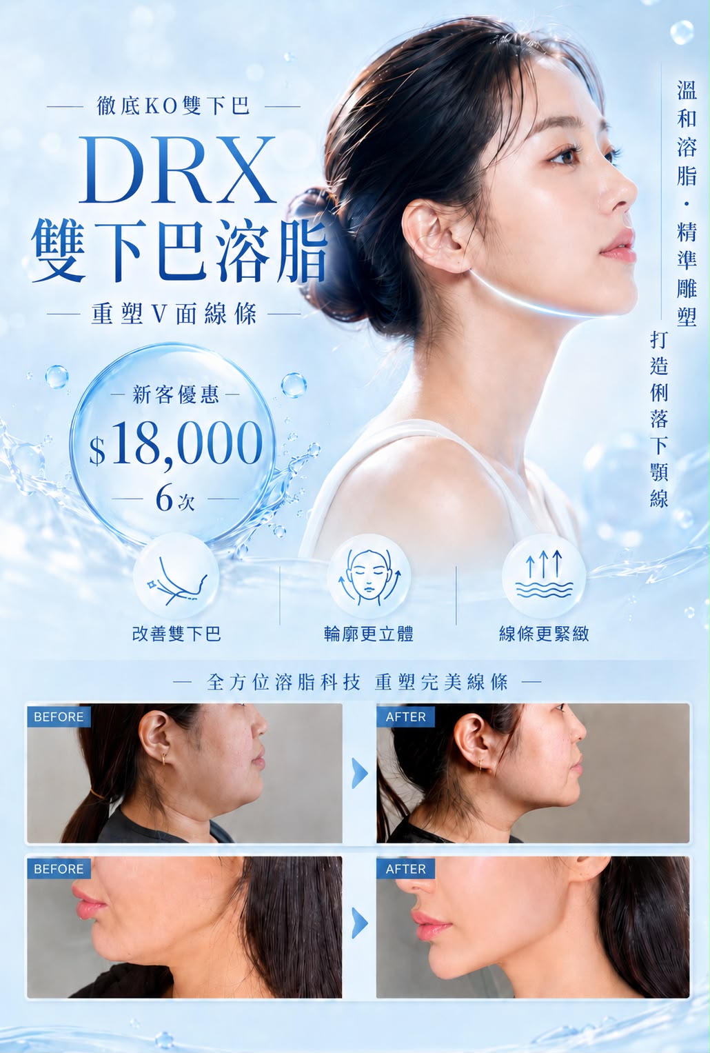 DRX 雙下巴溶脂