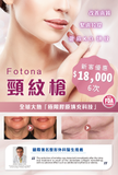 Fotona 頸紋槍