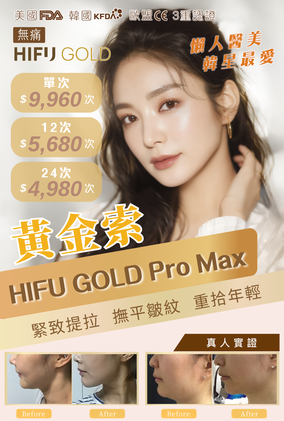 HIFU GOLD Pro Max黃金索