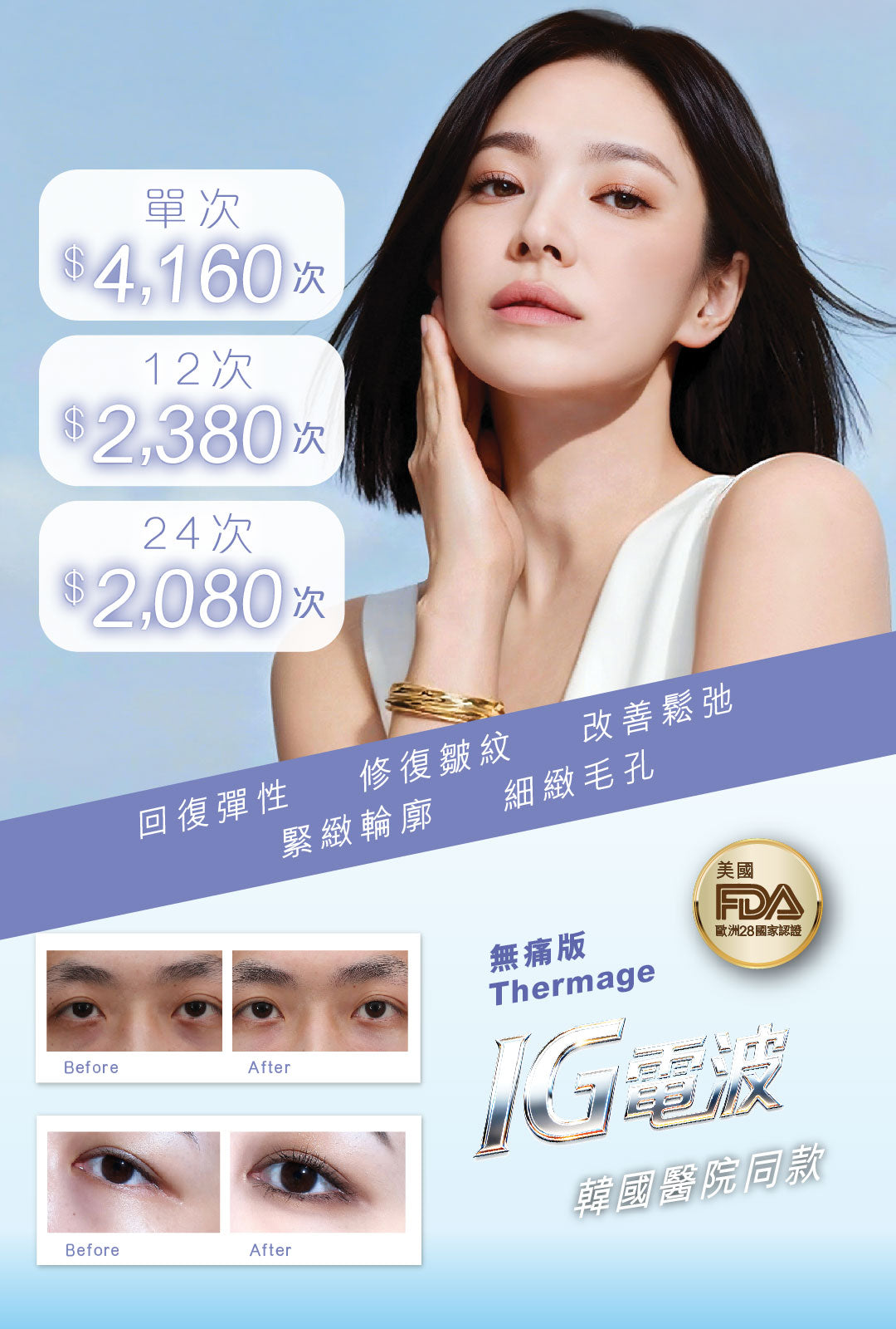 IG 電波拉皮療程 (眼)