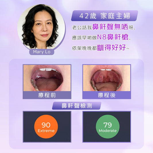 【新客網店優惠】N8包去鼻鼾療程✨$988/5次 | 送 專業超聲波檢測