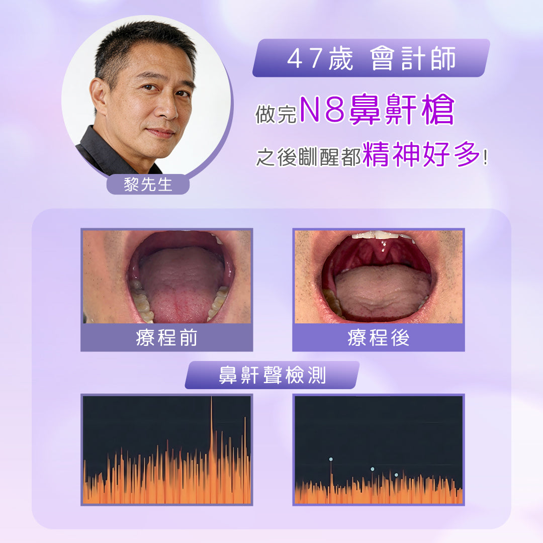 【新客網店優惠】N8包去鼻鼾療程✨$988/5次 | 送 專業超聲波檢測