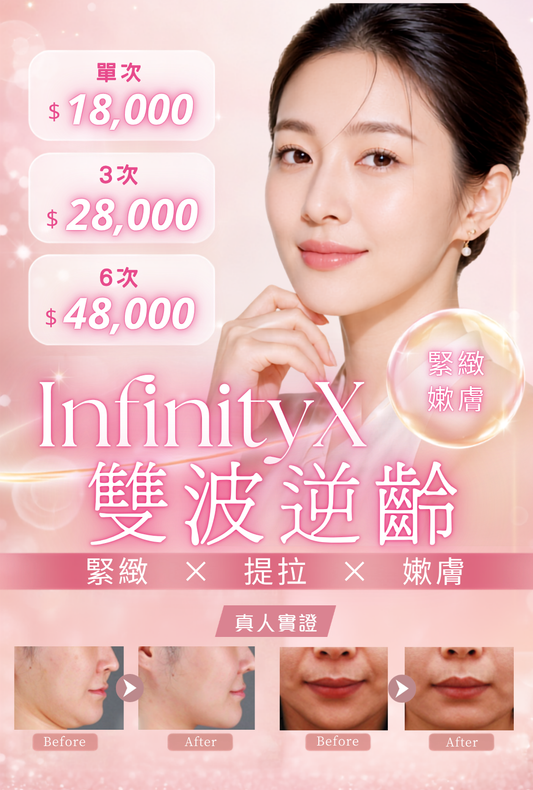 InfinityX 雙波逆齡
