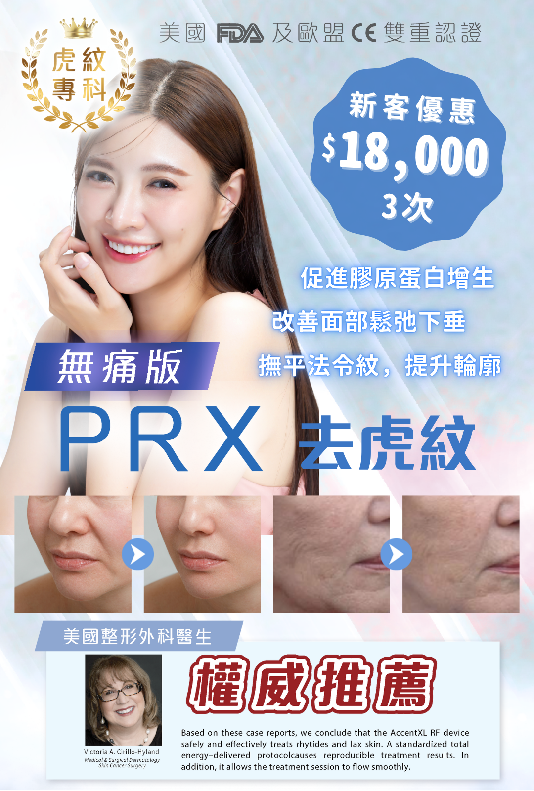 PRX 去虎紋