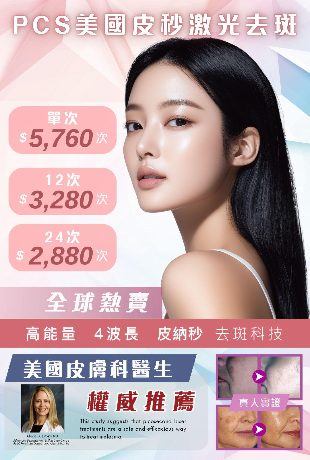 PCS美國皮秒激光去斑