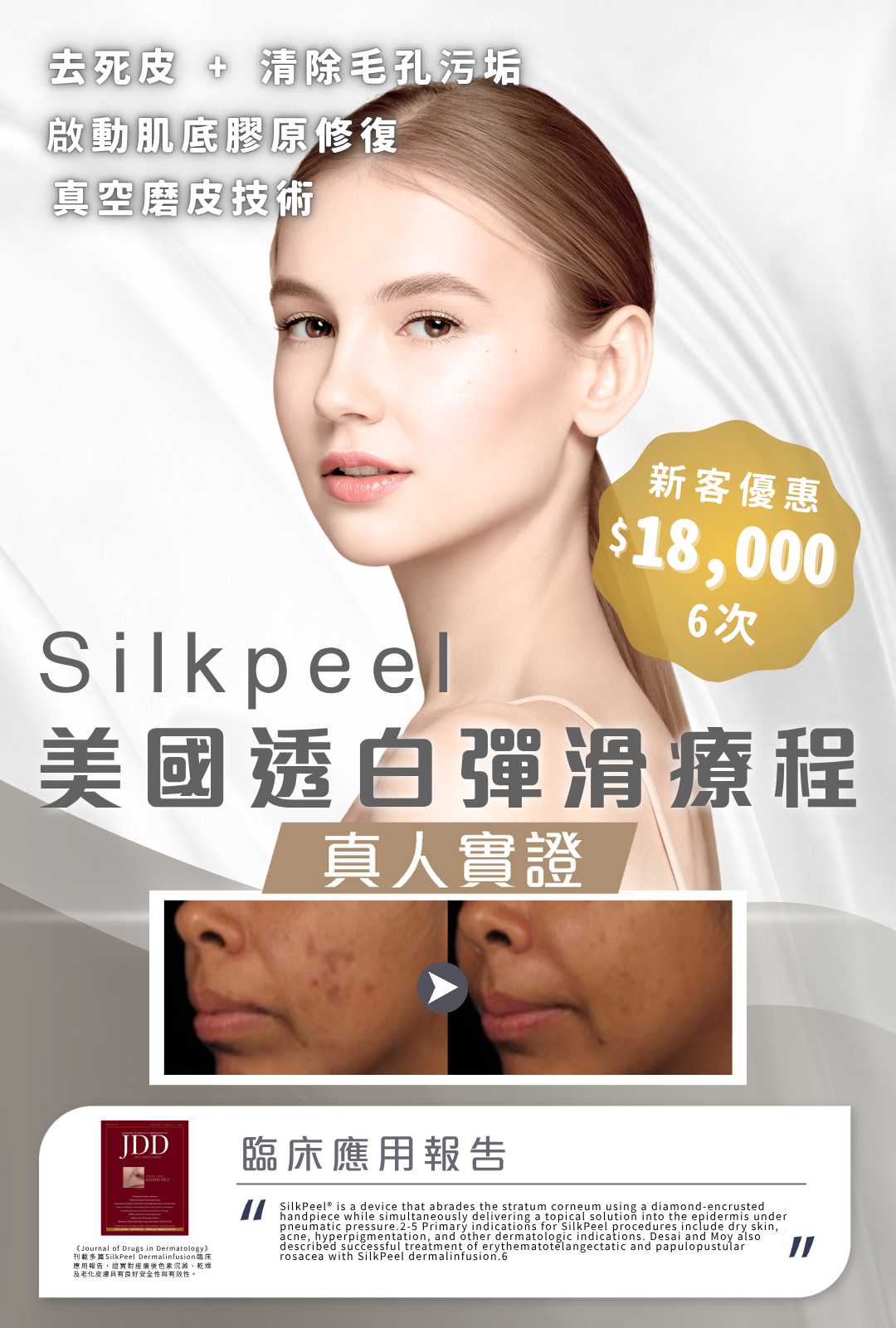 Silk Peel美國透白彈滑療程