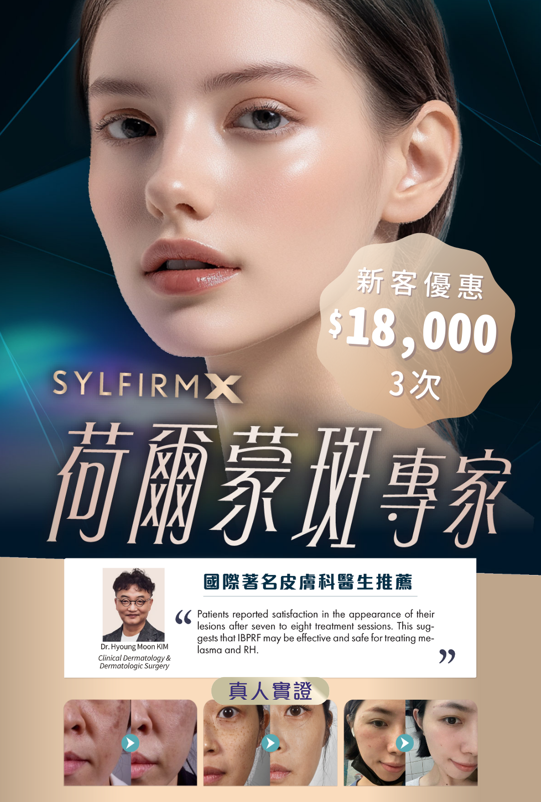 Sylfirm X荷爾蒙斑專家