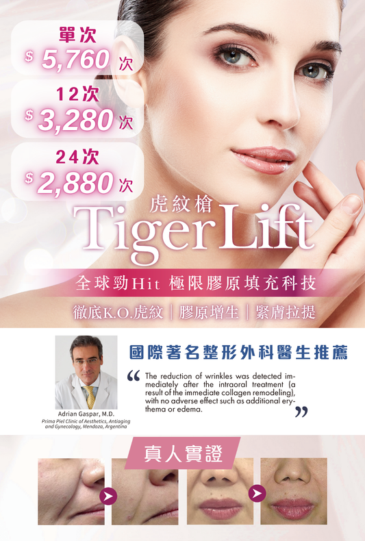 Tiger Lift虎紋槍